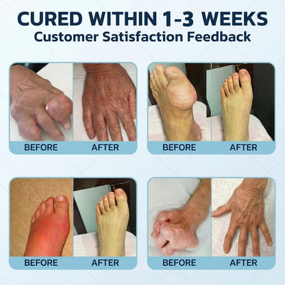 PLTOWE® NanoPenetrate Advanced Pain Relief Gel 🇺🇸 | Fast Comfort & Long-Term Joint & Muscle Care | Lidocaine + Menthol + MSM + Type II Collagen Formula | For Joint Pain, Muscle Soreness & Stiffness 💥