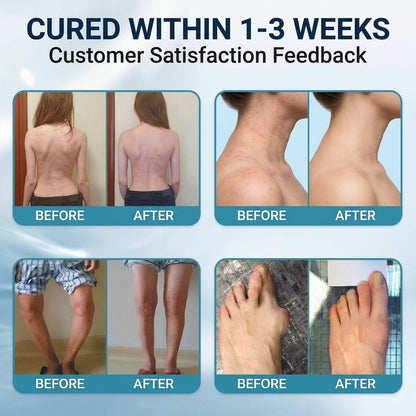 PLTOWE® NanoPenetrate Advanced Pain Relief Gel 🇺🇸 | Fast Comfort & Long-Term Joint & Muscle Care | Lidocaine + Menthol + MSM + Type II Collagen Formula | For Joint Pain, Muscle Soreness & Stiffness 💥
